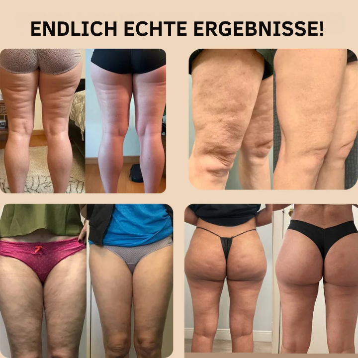 Winter Cellulite Ein-Naht Formende Fleece-Leggings